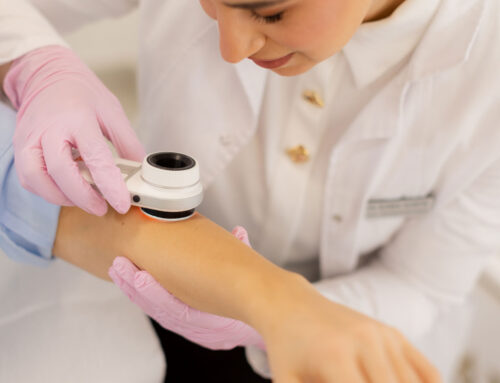 How to Perform a Self-Examination for Skin Cancer